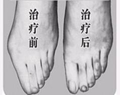 河源寬腳變窄價格