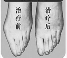 陽(yáng)江寬腳變窄價(jià)格