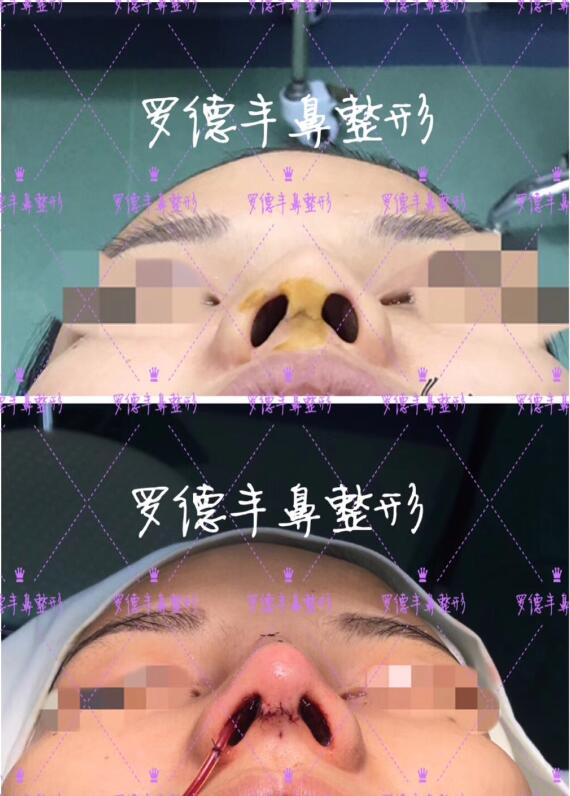 [ART_TITLE]
