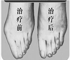 蚌埠寬腳變窄價格