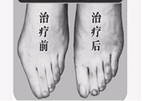 莆田寬腳變窄價格