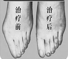 清遠寬腳變窄價格