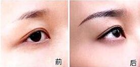 漳州切眉價格