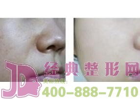 鹽城黑臉娃娃價格