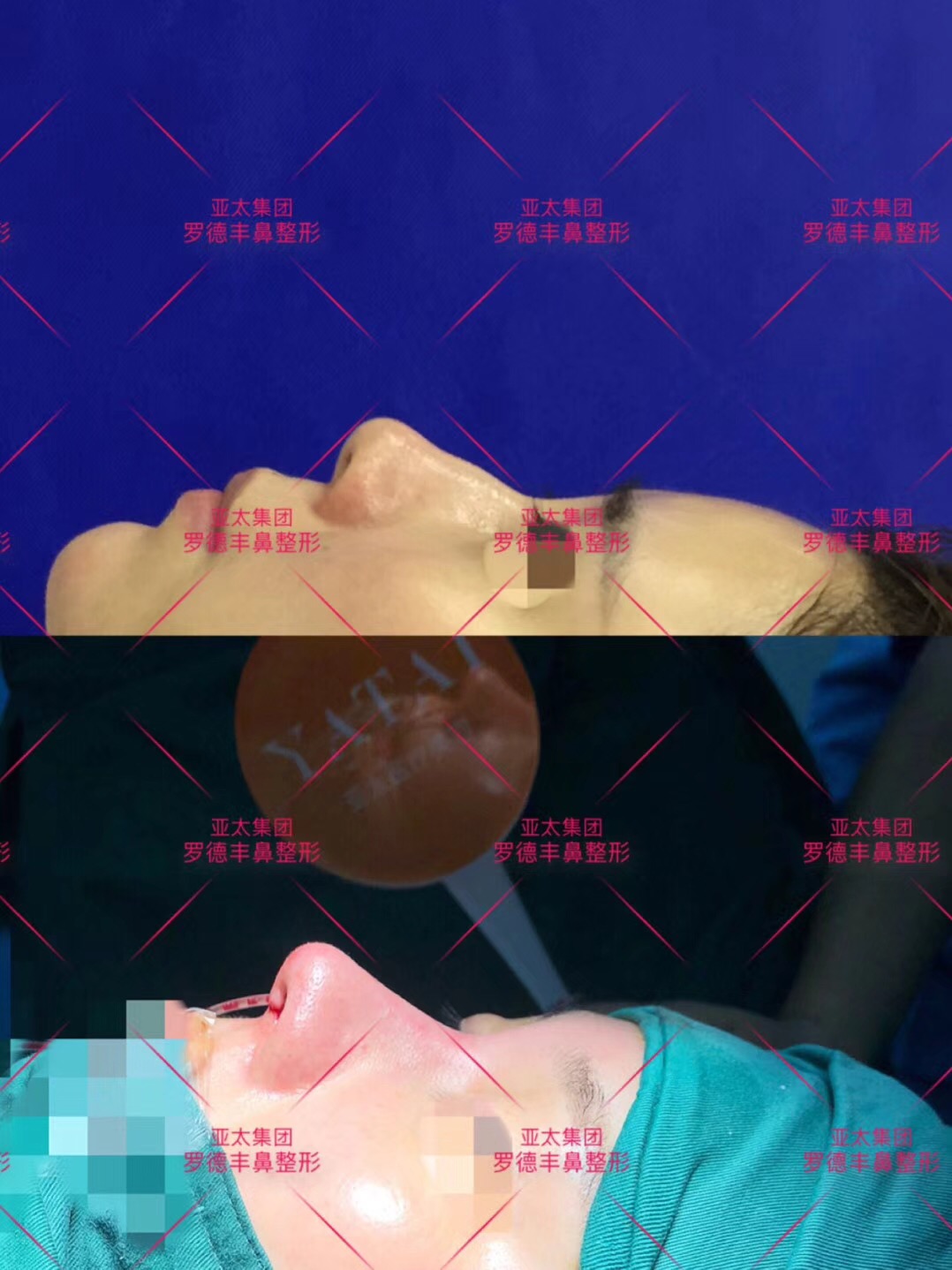 [ART_TITLE]