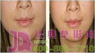 蕪湖人中再造價格