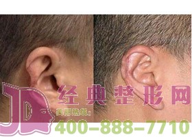 泰州耳部再造價(jià)格