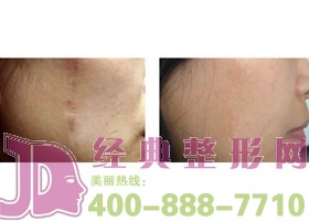 泰州植皮價(jià)格