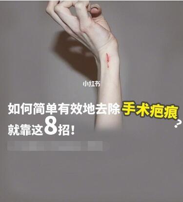 八招方法简单有效地去除手术疤痕