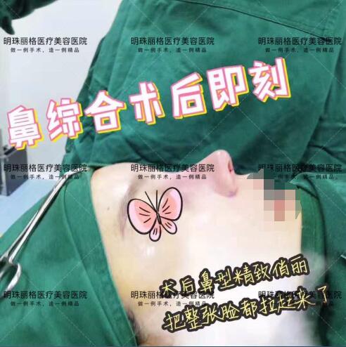 贛州明珠麗格520整形優惠活動