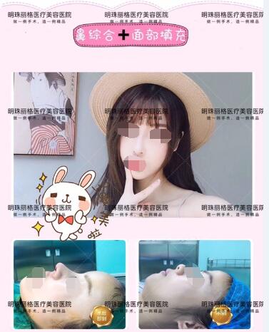 贛州明珠麗格520整形優惠活動