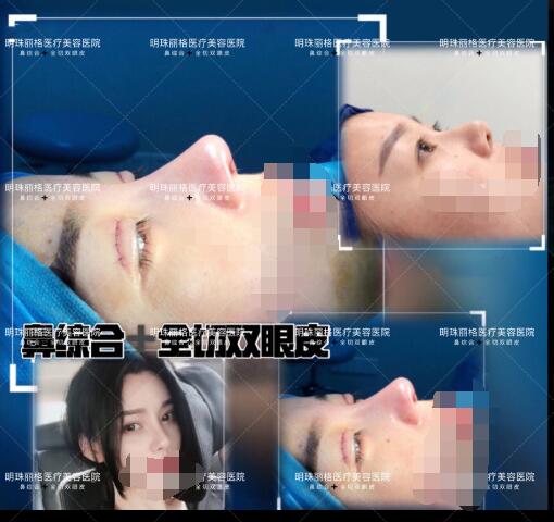 贛州明珠麗格520整形優惠活動