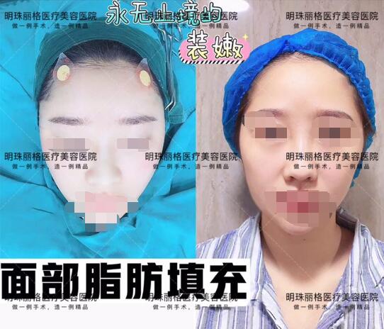 贛州明珠麗格520整形優惠活動