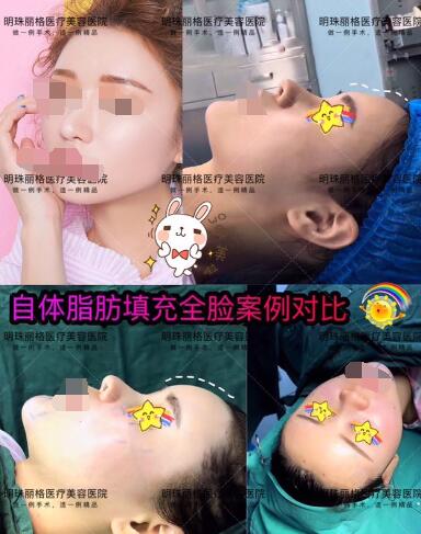贛州明珠麗格520整形優惠活動