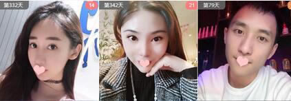 南宁脱发怎么办