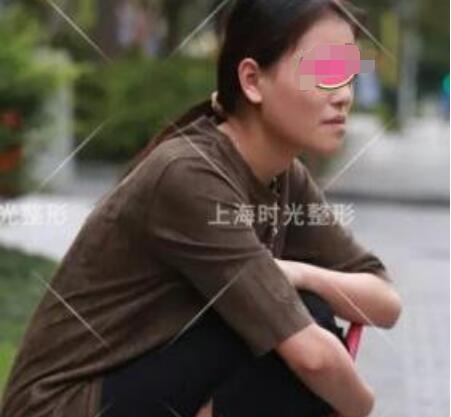 周口地包天報價30000-50000元/例