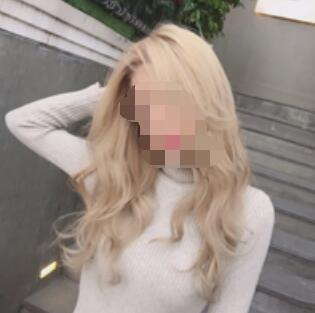 广州蜜桃假体隆胸案例