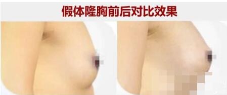 厦门孙明亮展示案例实力分享