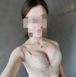 厦门假体隆胸案例