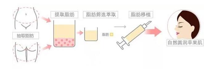 宝宝的苹果肌呢?这就告诉你,怎么获得苹果肌!