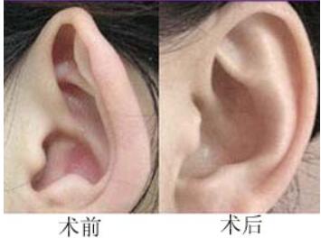 呼倫貝爾穿耳孔全新價格表上線了