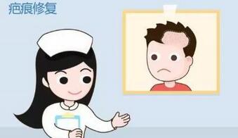 疤痕治疗预防大于治疗