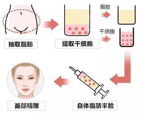 填充面部对量有要求