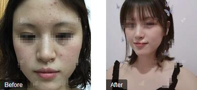 皮肤美容专家――上海德林整形王荩的面部抗衰年轻化技术