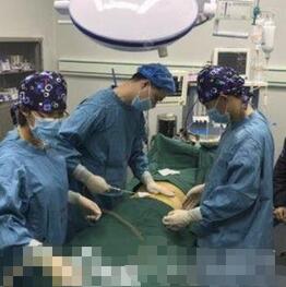 南宁市第二人民医院整形美容外科全身抽脂案例 瘦到100斤左右了
