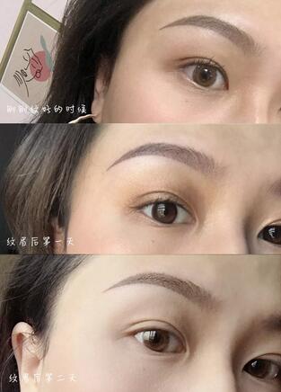 纹眉有什么好处?广州纹眉的价格参考+案例效果+过程