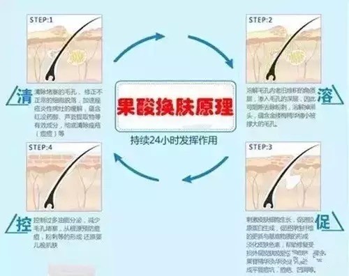 厦门做果酸换肤需要多少钱?术后注意事项你都了解吗?