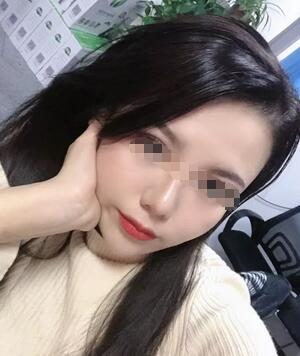 面部年轻化医生:武汉乐美整形汪文娟的埋线提升术