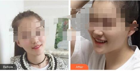 武汉整形做牙齿矫正手术口碑好的医生--陈康