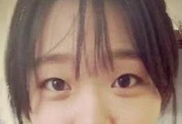 双眼皮案例 我自己都被惊艳到了，秒变小仙女
