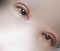双眼皮后这么快做到无痕，你们要学着点哈！哈哈
