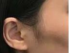 阿拉善豐太陽穴五月全新價格表上線了 7000-15000/例 