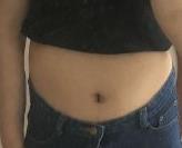 吸脂術后3個月身材變化很大：成為了一個很性感的小女人，好滿意