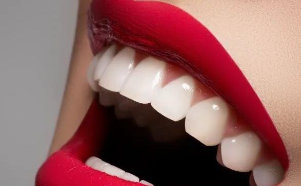 种植牙案例：术后30天牙齿状态变得越来越好了，天生的牙齿一般