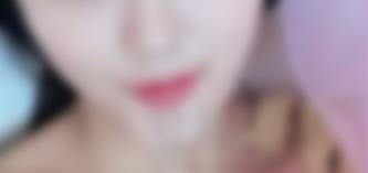 玻尿酸面部填充经历：面部看上去更加的饱满，变得越来越年轻