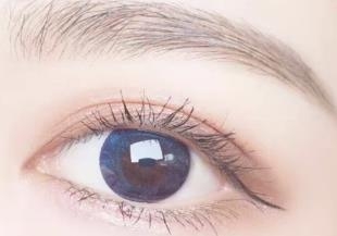 做雙眼皮手術(shù)恢復(fù)后效果+圖片：眼睛看上去特別的漂亮美觀(guān)