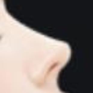 自从做完隆鼻手术之后，我的鼻子变得特别的立体