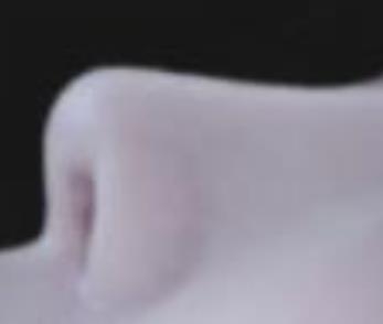 做隆鼻手术恢复了之后的鼻子真的特别的漂亮
