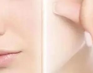面部提升之后的效果：皮肤紧致光滑就可以看上去更年轻