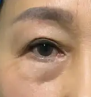 常見抗衰項目有哪幾類